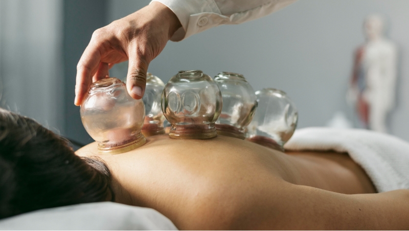 부항 치료중인 환자